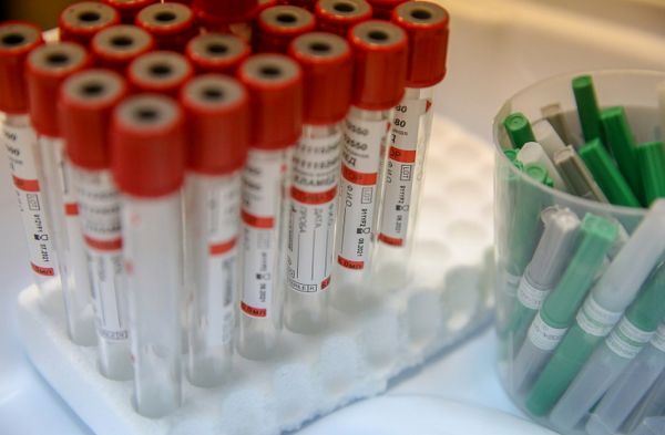 primorsky.ru |  Тестов на коронавирус проводят все больше